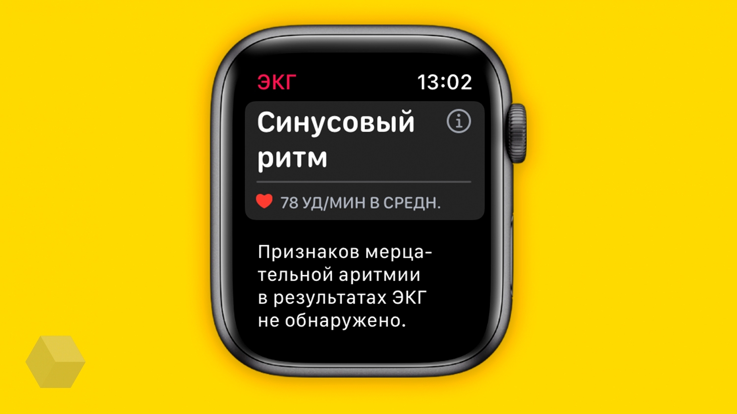 10 функций Apple Watch, чтобы привести своё здоровье в порядок - Rozetked.me