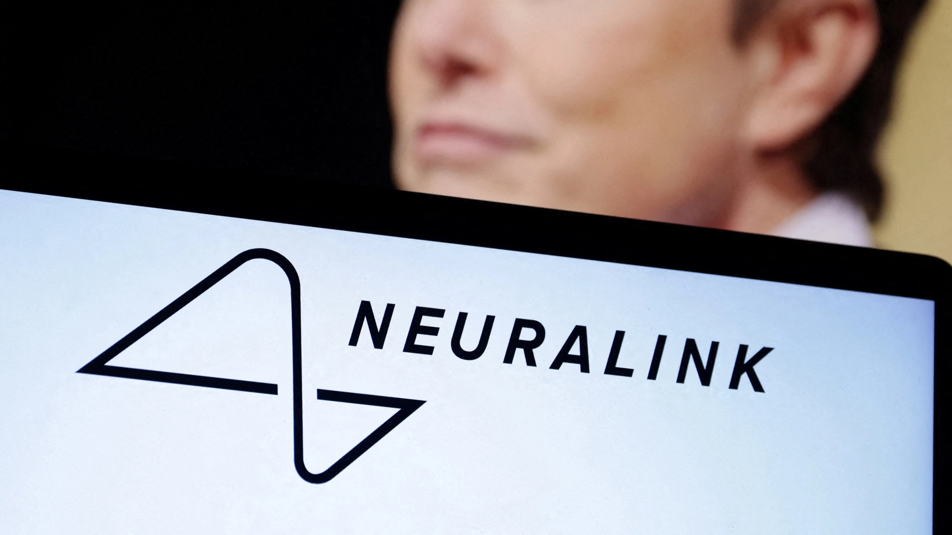 Neuralink вживила нейрочип в мозг второго пациента