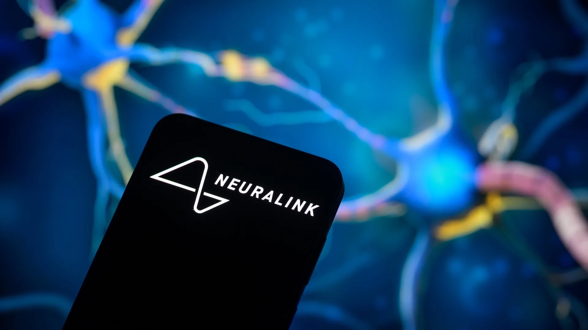 Пациент Neuralink научился управлять моделью самолёта силой мысли
